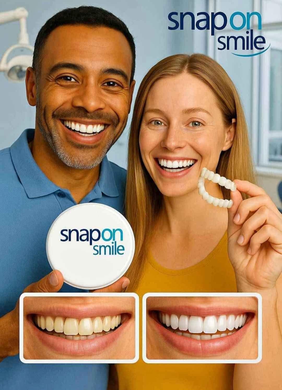 Carillas Dentales Snap-On Smile - Set x2