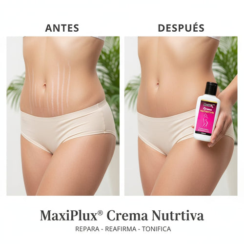 Crema Reafirmante Anti-Estrías y Anti-Celulitis con Obsequio Especial