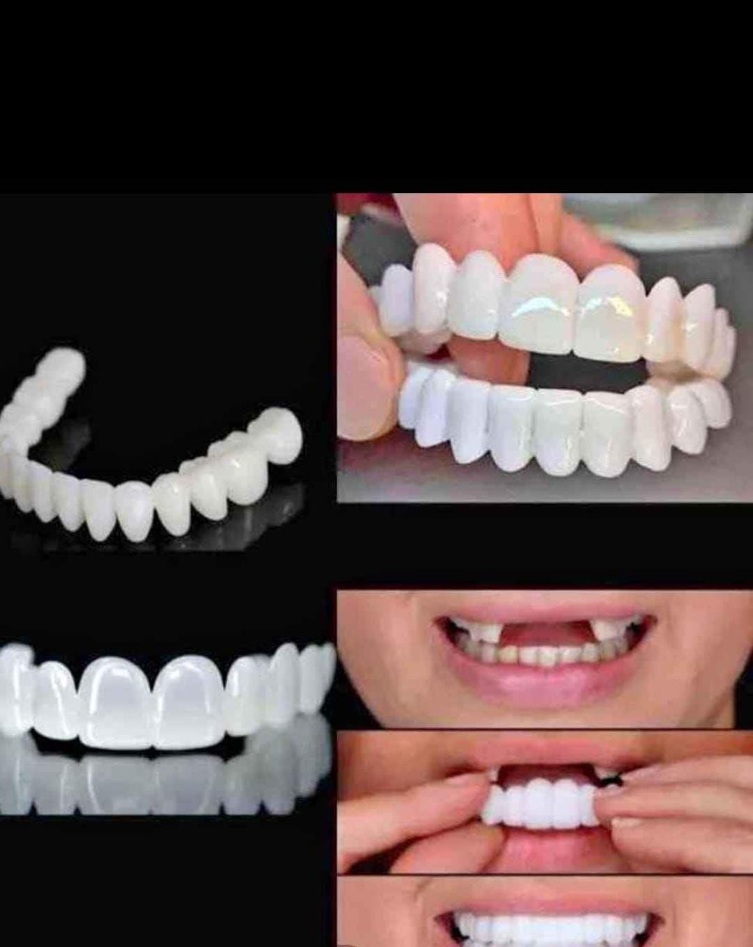 Carillas Dentales Snap-On Smile - Set x2