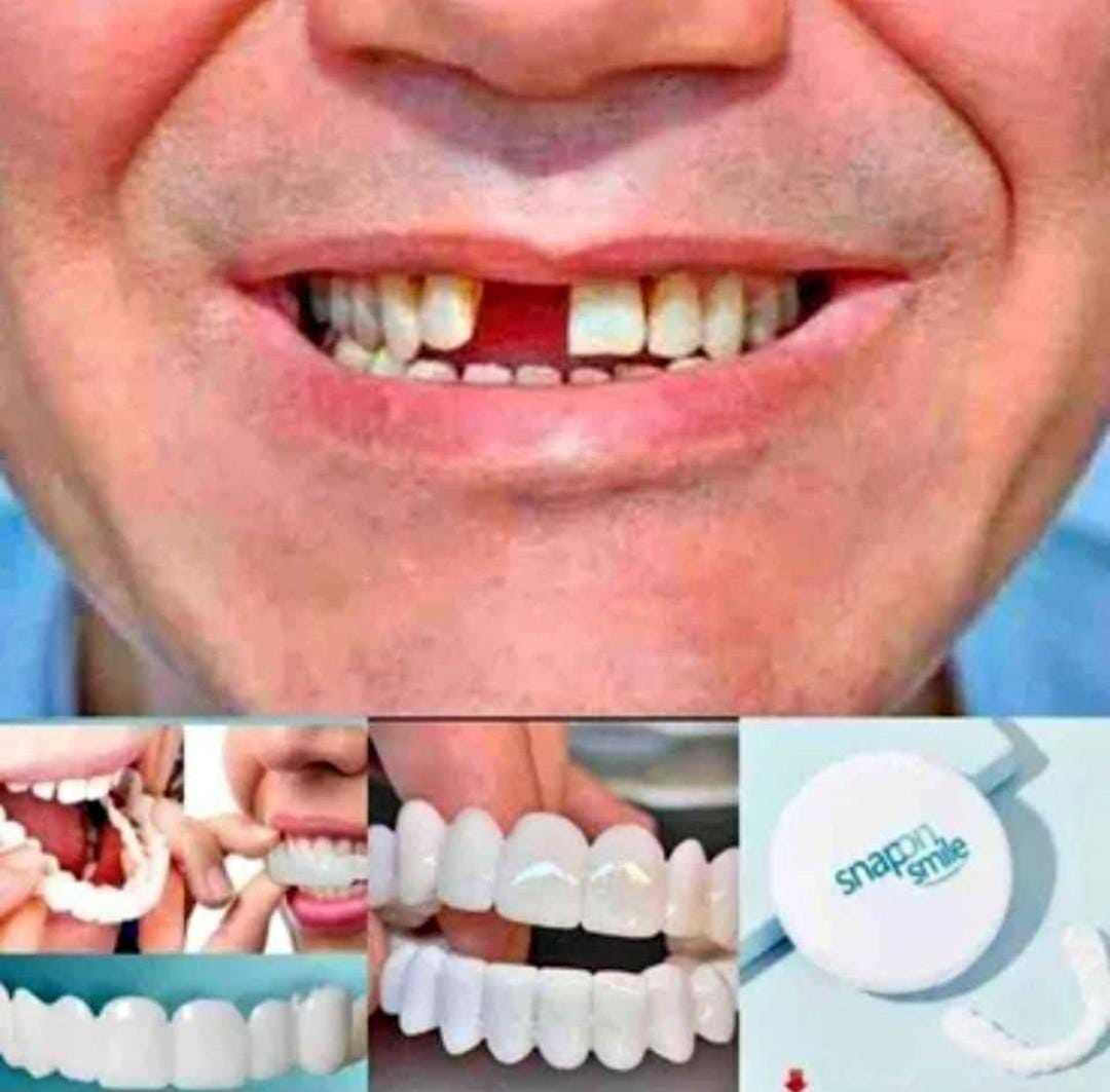 Carillas Dentales Snap-On Smile - Set x2