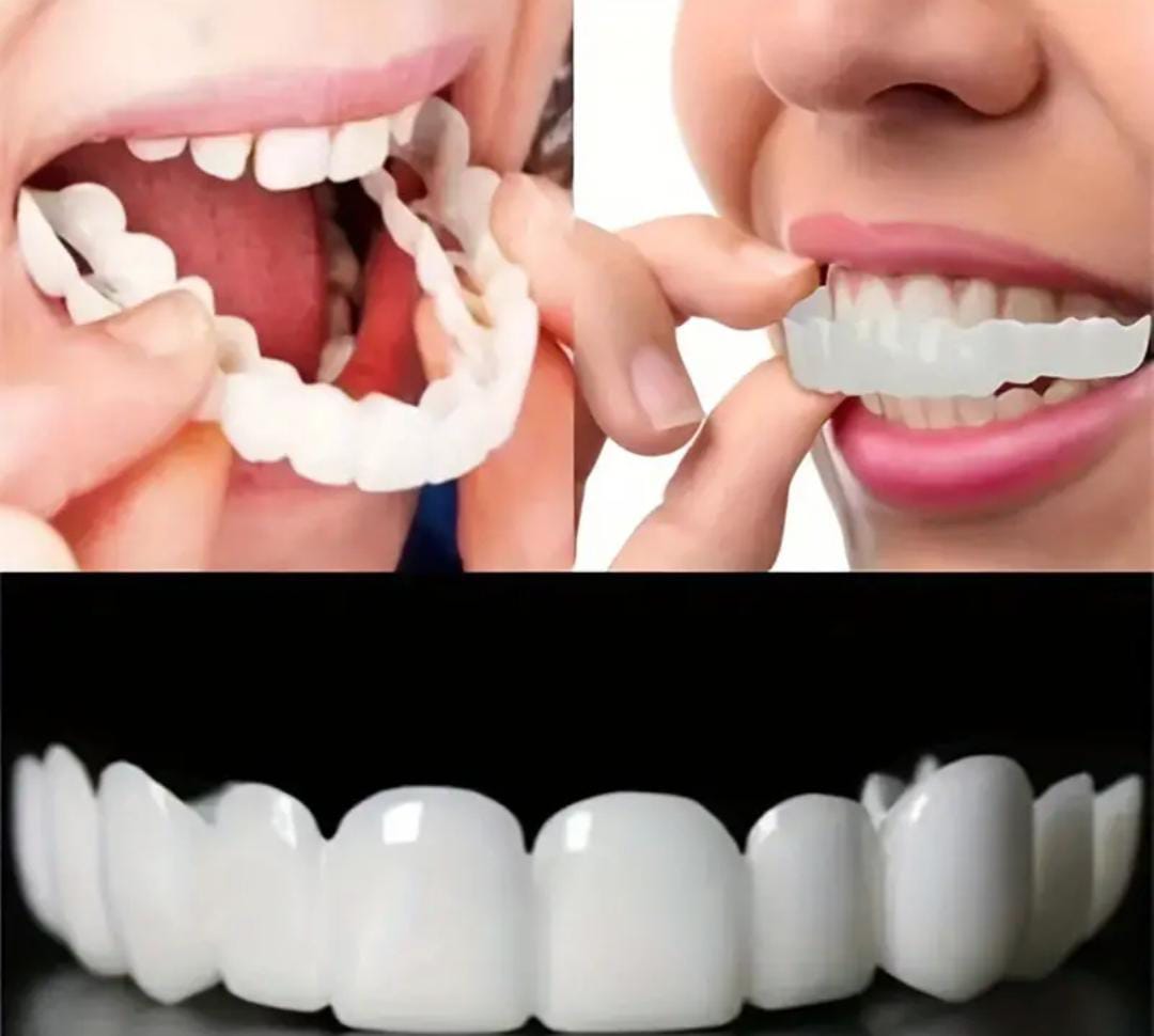 Carillas Dentales Snap-On Smile - Set x2